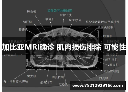 加比亚MRI确诊 肌肉损伤排除 可能性